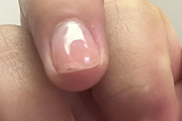 builder gel peeling gel nails lifting base coat adhesion builder gel top coat HEMA-free gel gel nail problems nail prep