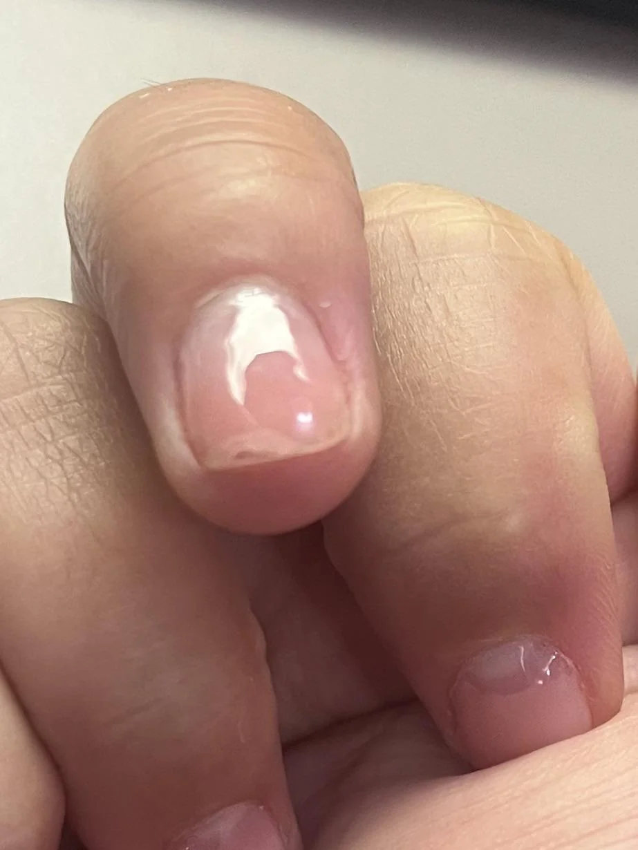 builder gel peeling gel nails lifting base coat adhesion builder gel top coat HEMA-free gel gel nail problems nail prep